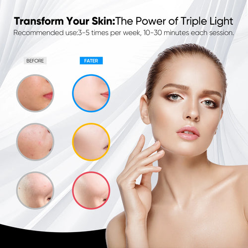 GlowGuard Pro Light Therapy Mask